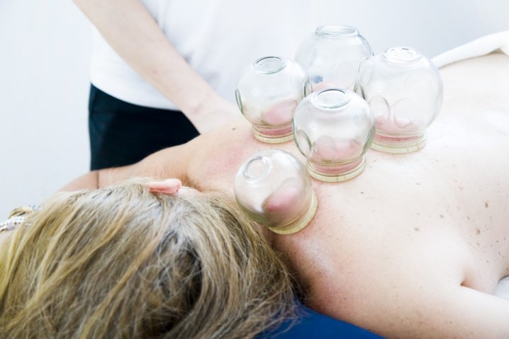 Cupping Massage Therapy Portland Oregon