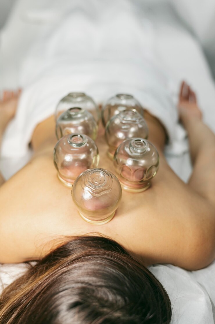 Cupping Massage Therapy Portland Oregon